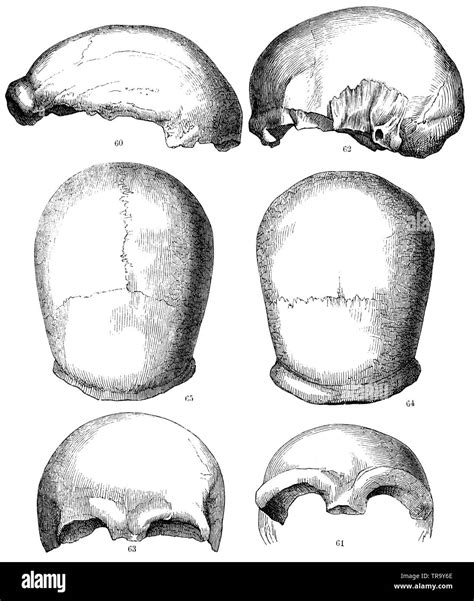 Neanderthal Skull Diagram