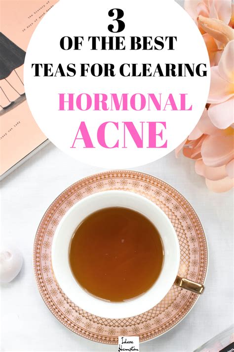 Hormonal Acne Artofit