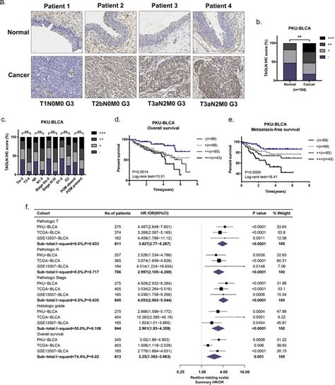 Tagln Overexpression Correlates With The Presence Of Poor Prognostic