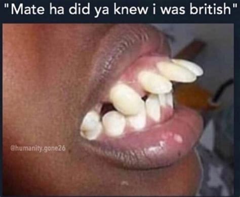 🤦‍♂️ British people don't actually have bad teeth : r/facepalm