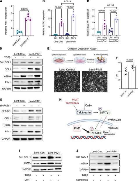 Jci Insight Transcriptional Analysis Of Lung Fibroblasts Identifies