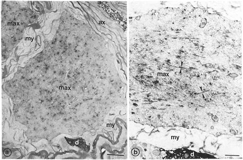 Electron Micrographs Of Vibratome Sections Of The Dilated Cns Portion