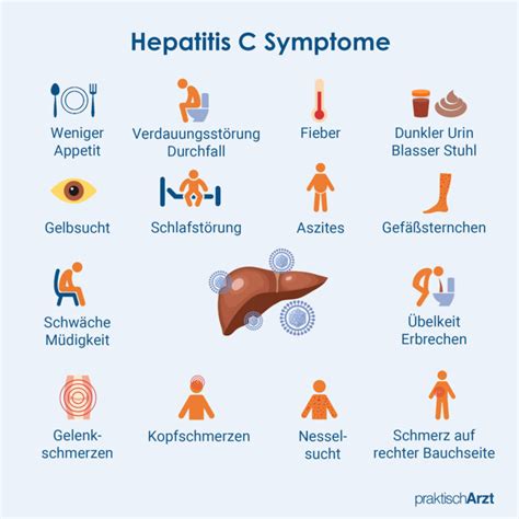 Hepatitis C PraktischArzt