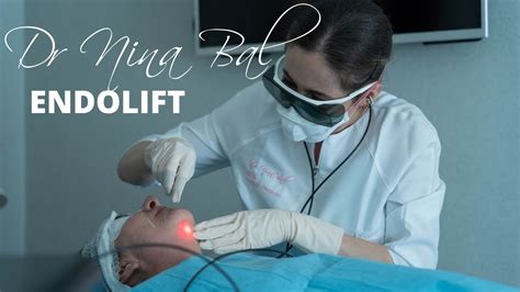 Endolift Non Surgical Face Lift Endolift Procedure Endolift Before