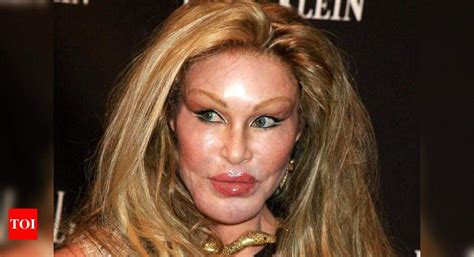 8 Celebrity Plastic Surgery Gone Bad! Really Bad! - Times of India