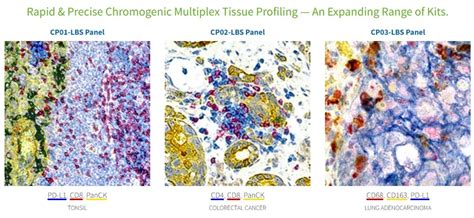 Chromogenic Multiplex IHC For BOND RX RX M IHC ISH