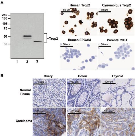 Expression Of Trop Cell Surface Glycoprotein In Normal And Tumor