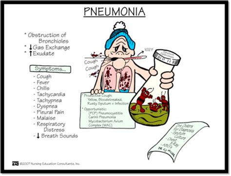 Chapter Infectious Respiratory Disorders Flashcards Quizlet