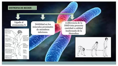 Presentacion Distrofia Muscular Ppt Descarga Gratuita