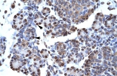 Ctbp1 Antibody Cat No 27 608 Prosci