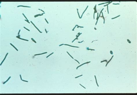 Clostridium Microbewiki