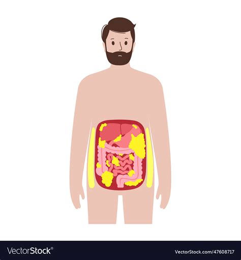 Visceral Fat Diagram Royalty Free Vector Image