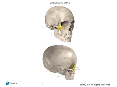 Zygomatic Bone Diagram Quizlet