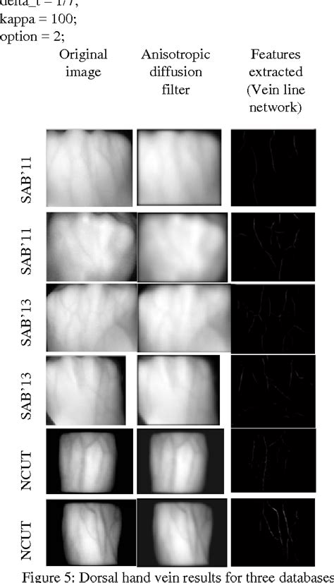 Figure 1 From Anisotropic Diffusion Filter For Dorsal Hand Vein