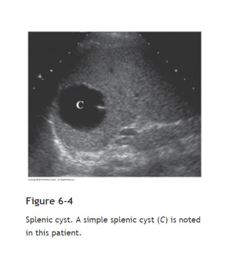 Spleen Pathology Flashcards Quizlet