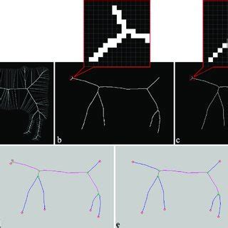 Workflow Of The Proposed Image Processing Method For The Segmentation