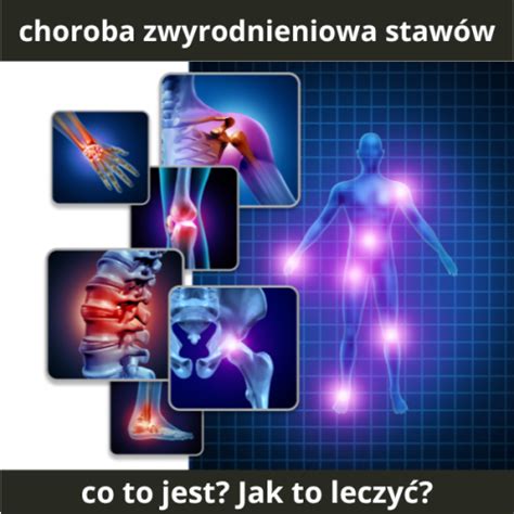 Zwyrodnienie Staw W