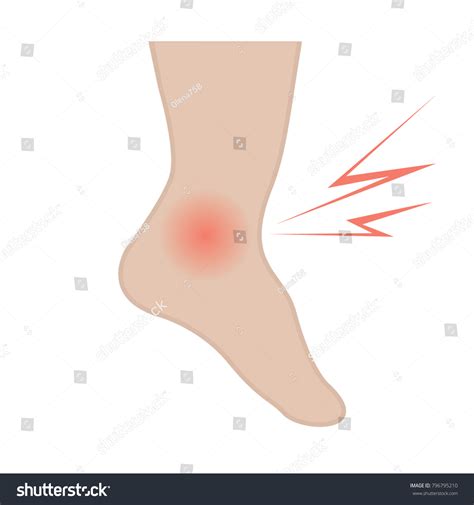 Swelling Feet Ankles Infected Injury Stock Vector (Royalty Free) 796795210