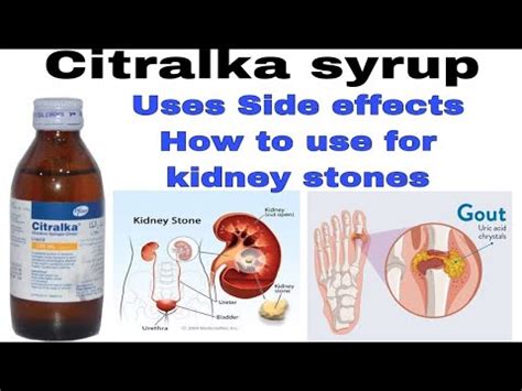 Citralka Syrup Uses Benifits And Side Effects In Urdu Hindi YouTube