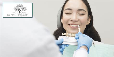 Things To Know Before Getting Dental Veneers Oaks Dental