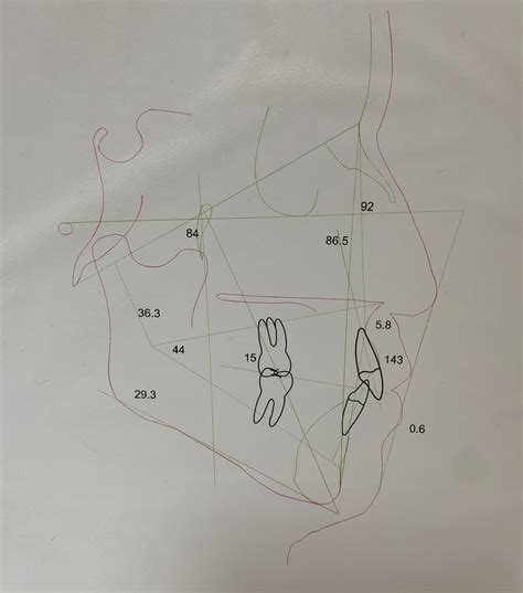 Ortodoncia Centro Radiológico Especializado Dental