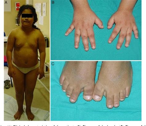 Figure 1 From Clinical And Radiological Findings In A Case Of