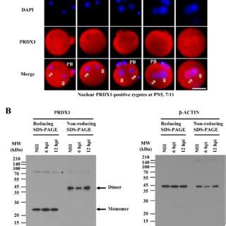 Localization Of Prdx So In Zygotes And Somatic Cells A