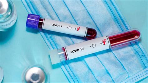 За добу на Рівненщині виявили 137 нових випадків COVID-19 - Новини ...