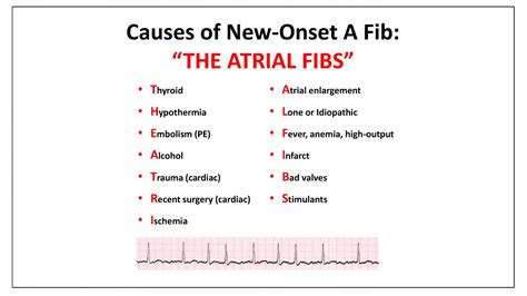 Atrial Fibrillation Symptoms Ecg Causes Treatment 51 Off