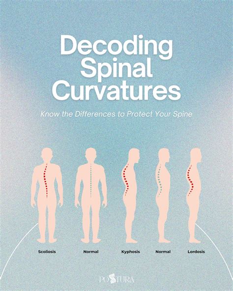 cebu center  scoliosis  osteopathy