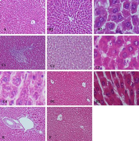 Photomicrographs Of Liver Sections From A A Control Rat Showing Download Scientific Diagram