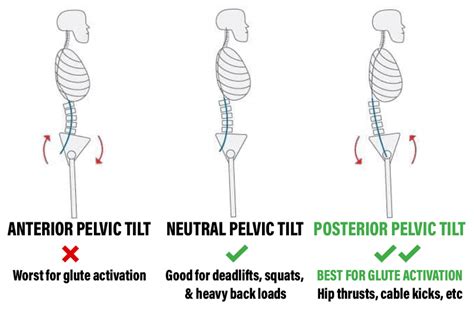 Weightlifting Why Is Said To Be Safe To Posteriorly Tilt The Pelvis