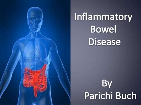 Inflammatory Bowel Disease