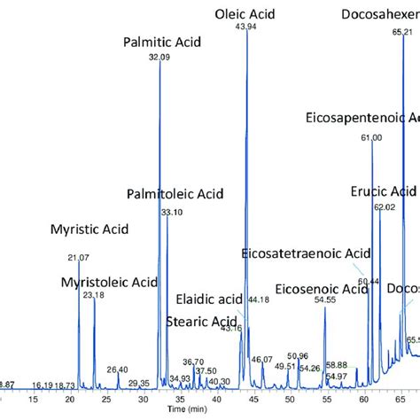 Gc Ms Chromatogram Of Fatty Acid Methyl Esters Fames Obtained From