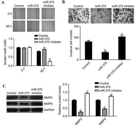 MicroRNA 375 Targets PAX6 And Inhibits The Viability Migration And