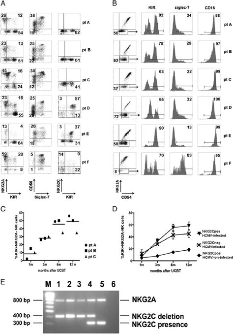 Lack Of NKG2C Expression In NK Cells Developing In Patients Given UCBT