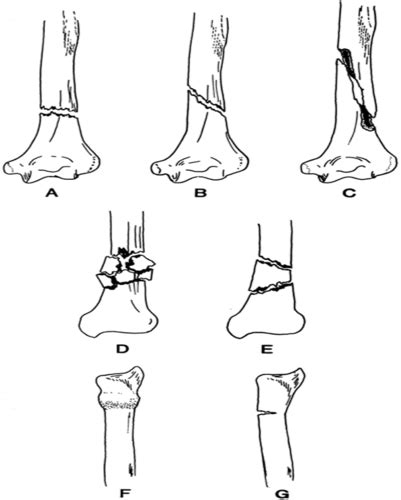 Ed Ortho Flashcards Quizlet