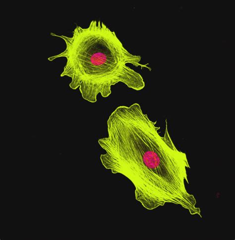 target-cell-image | Treadwell Therapeutics