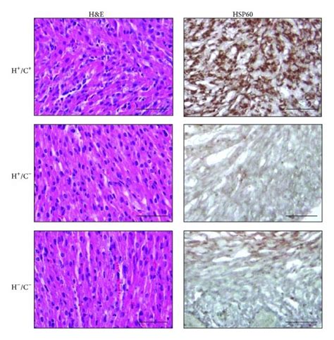 Hsp60 Detection In Neonatal H⁺ C⁺ Mice Heart Hande And Download