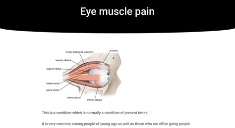 Eye muscle pain | IrisTech