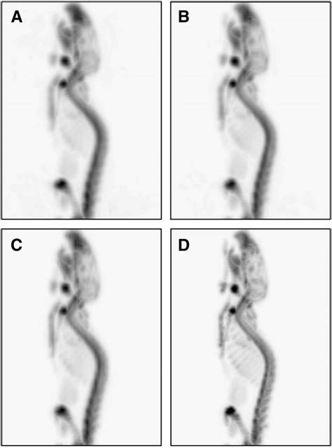 Maximum Intensity Projection Mip Images Of Mouse Bone F Pet