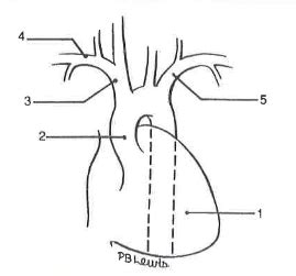 A&P: aortic arch branches Diagram | Quizlet