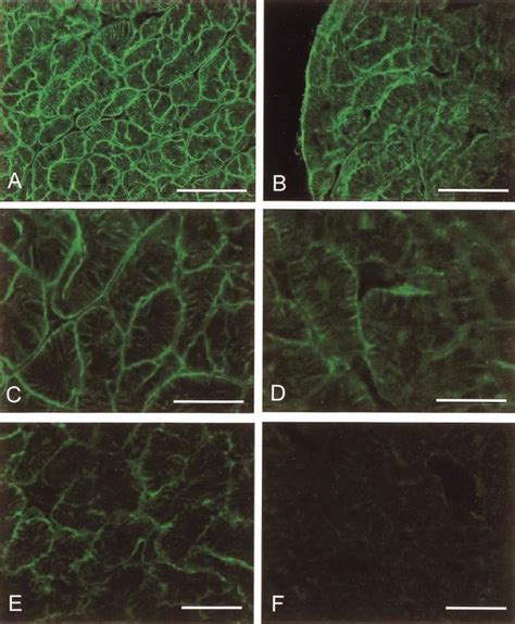 Immunohistochemical Labeling Of Dystroglycan And Sarcoglycan A