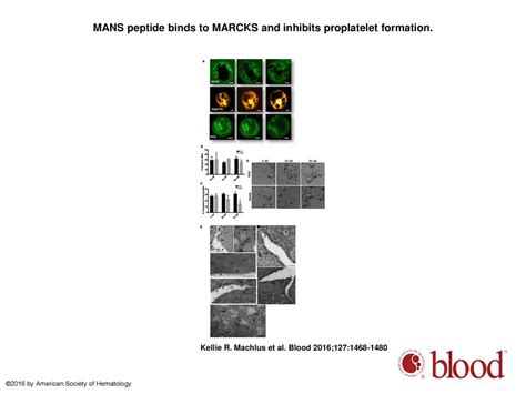 Synthesis And Dephosphorylation Of MARCKS In The Late Stages Of