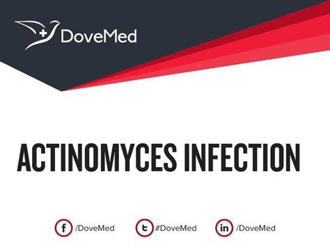 Actinomyces Infection