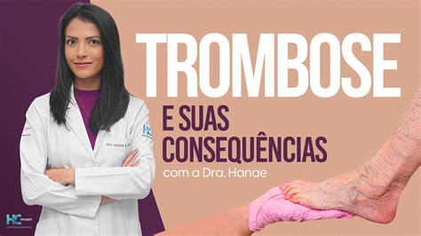 Trombose Tudo que você precisa saber sobre as causas e consequências