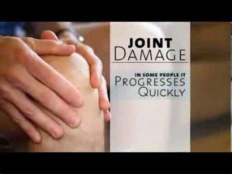 Osteoarthritis And Viscosupplementation Treatment Explained By Colorado