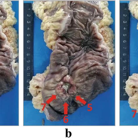 Labeling Of The Tumor Visible Margin With Naked Eyes A Visible Tumor