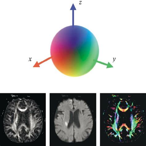 Image Based Visualization Of Diffusion Tensor Data Top Sphere