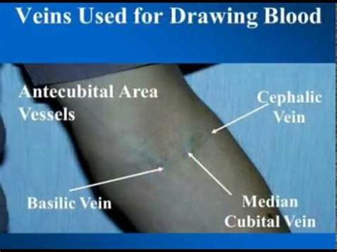 Iv Injection Sites Diagram Injection Intravenous Sites Admin